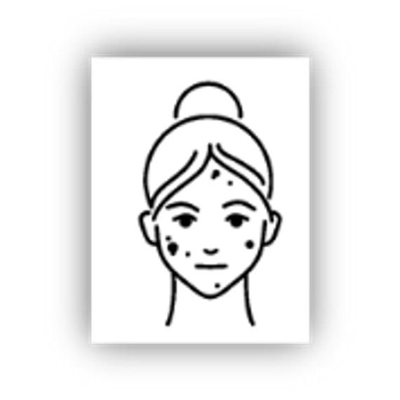 PURE SKIN SOLUTION Pattanásszárító krém ZnO