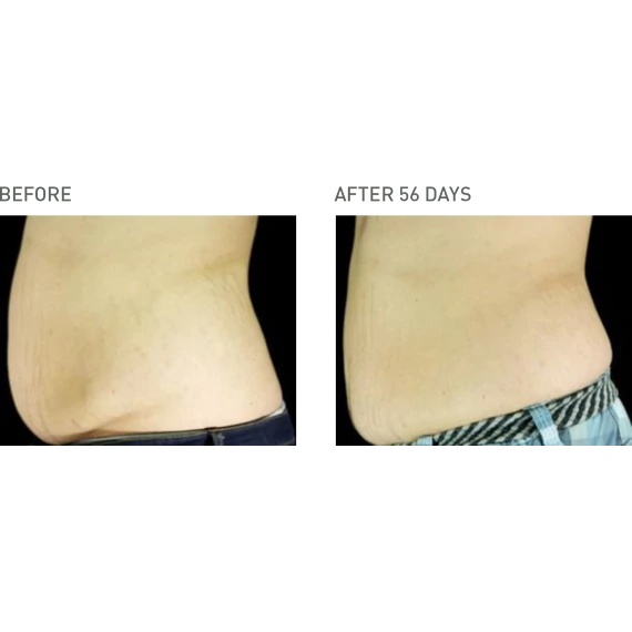 ANTI-CELLULITE FAT-LOSS BODY Zsírégető testápoló krém