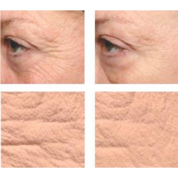 PERFECT CODE Peptides fiatalító szérum 