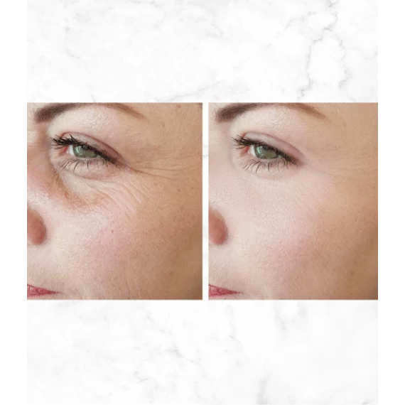 MULTIACTIVE Hyaluron & B5 BOOST SHOT 