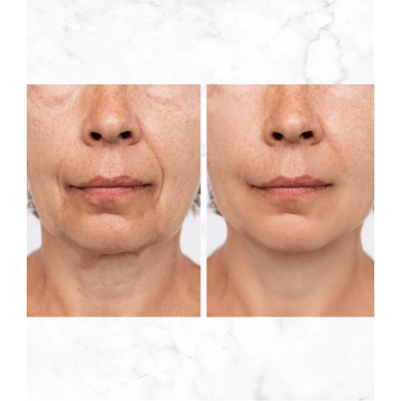 MULTIACTIVE Retinol SHOT