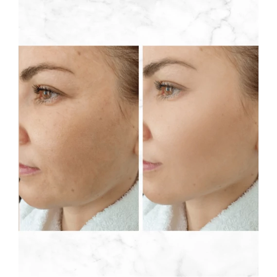 MULTIACTIVE Bakuchiol Phyto Retinol SHOT