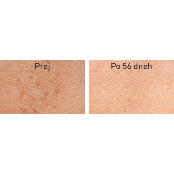 VITAMIN C EXPERT Ultrahidratáló krémgél normál, vegyes bőrtípusra