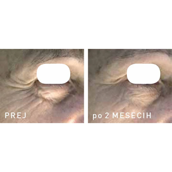 3PEPTIDES Szemkörnyékápoló krém ráncok, sötét karikák ellen 2.0 15 ml