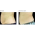 ANTI-CELLULITE FAT-LOSS BODY Zsírégető testápoló krém