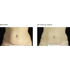 ANTI-CELLULITE FAT-LOSS BODY Zsírégető testápoló krém